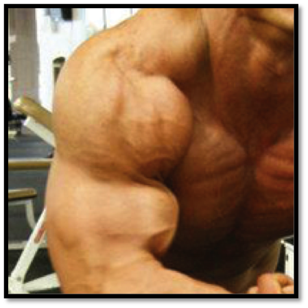 Shoulder Workouts