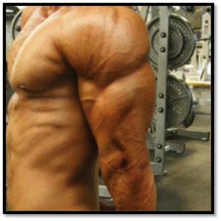 Tricep Workouts